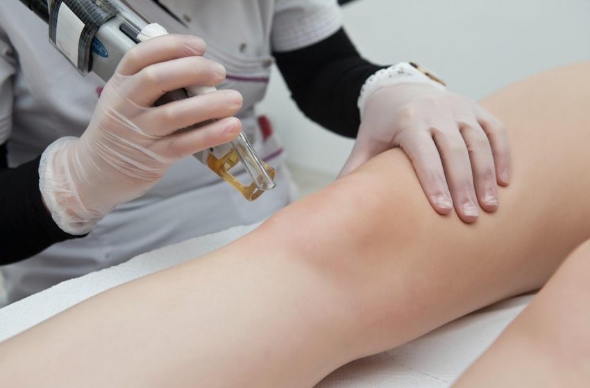 Laser Hair Removal: 13 Things You Need to Know Before Having the Treatment