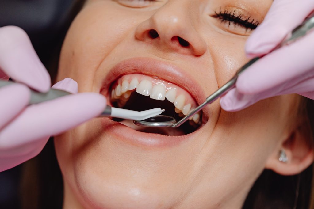 6 Things You Need to Know Before Getting Dental Braces