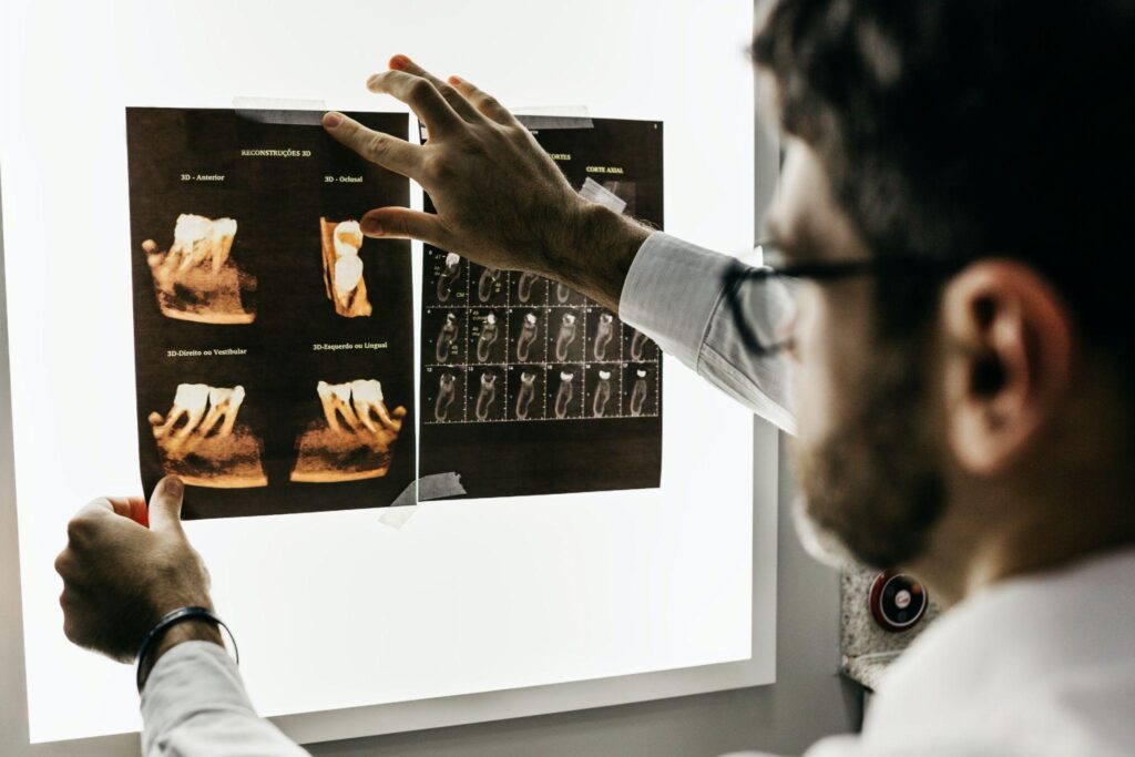 Bruxism Damage