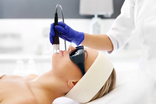  How Often Can You Have a Hair Removal Treatment?