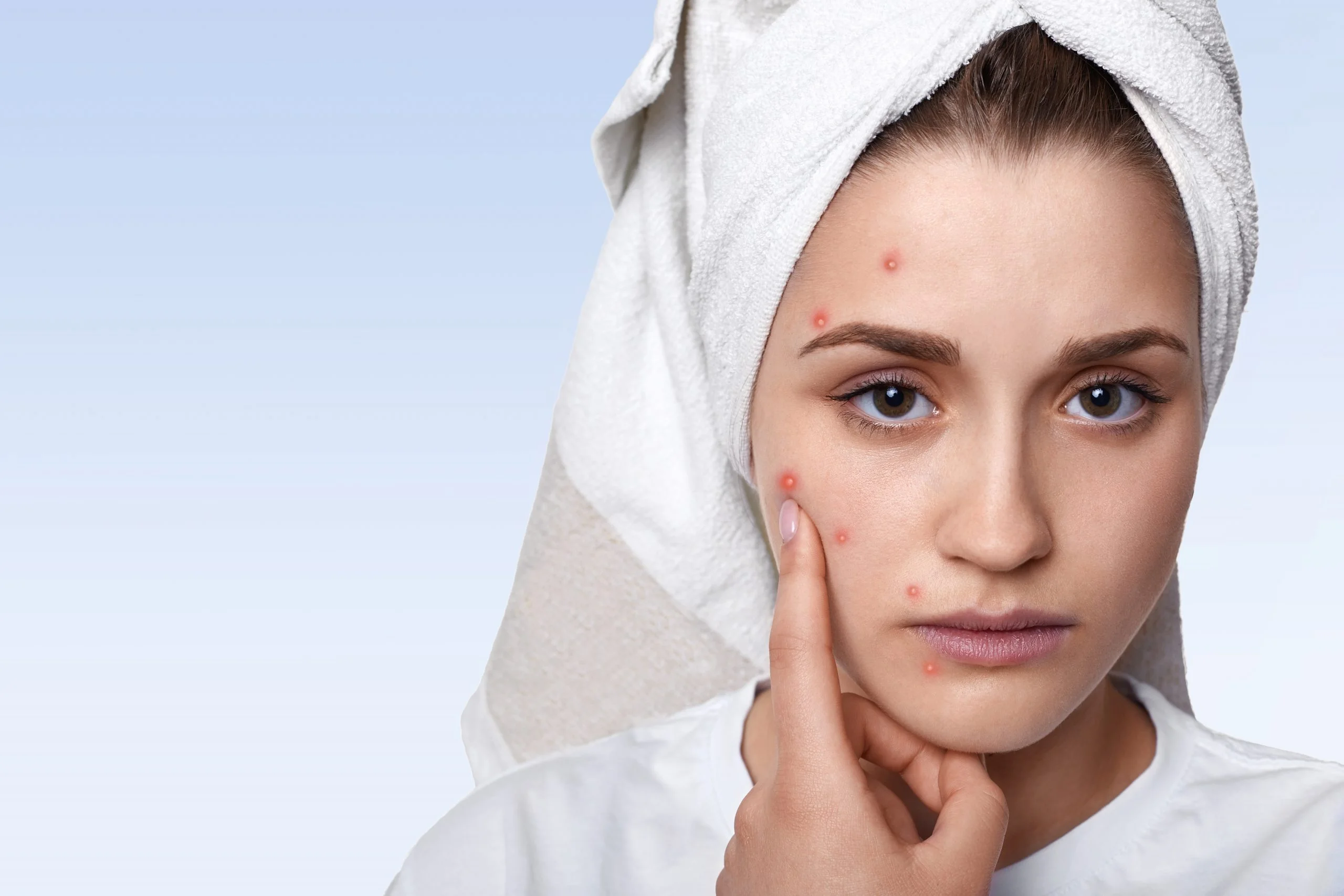  You Can Try These 16 Home Remedies for Warts Right Now