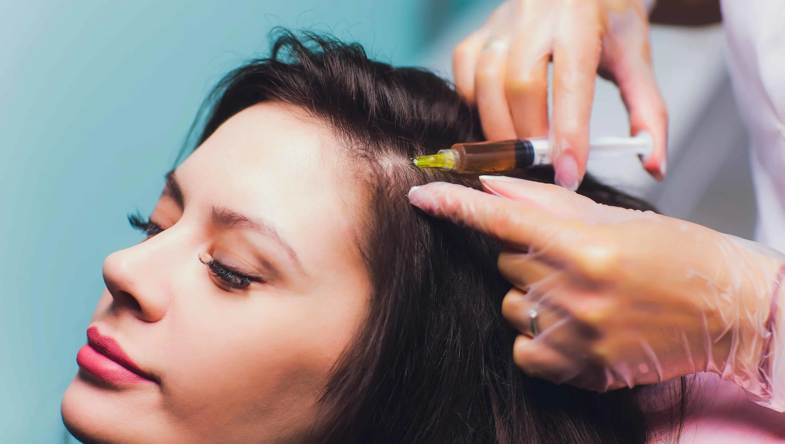  How Effective is PRP for Hair Loss and Restoration Treatment?